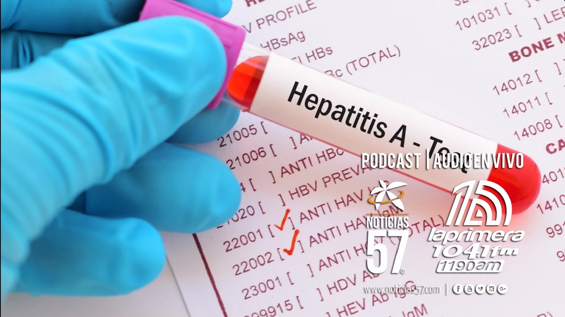 Incrementa el número de casos por Hepatitis A en el sur de la Florida