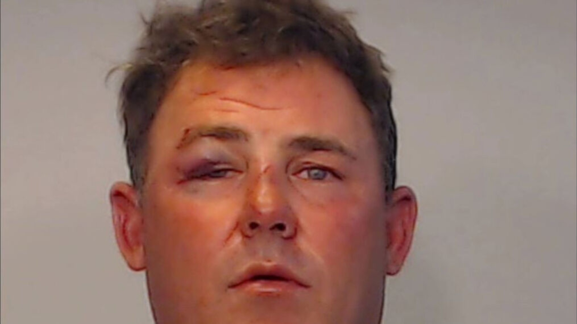 Hombre de Port St. Lucie arrestado por morder la oreja de otro